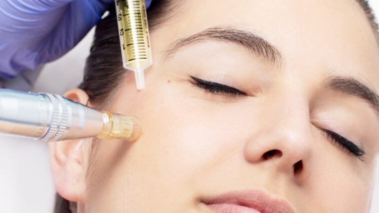 Mesotherapy